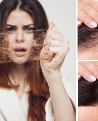 5 cách khắc phục rụng tóc ở nữ giới