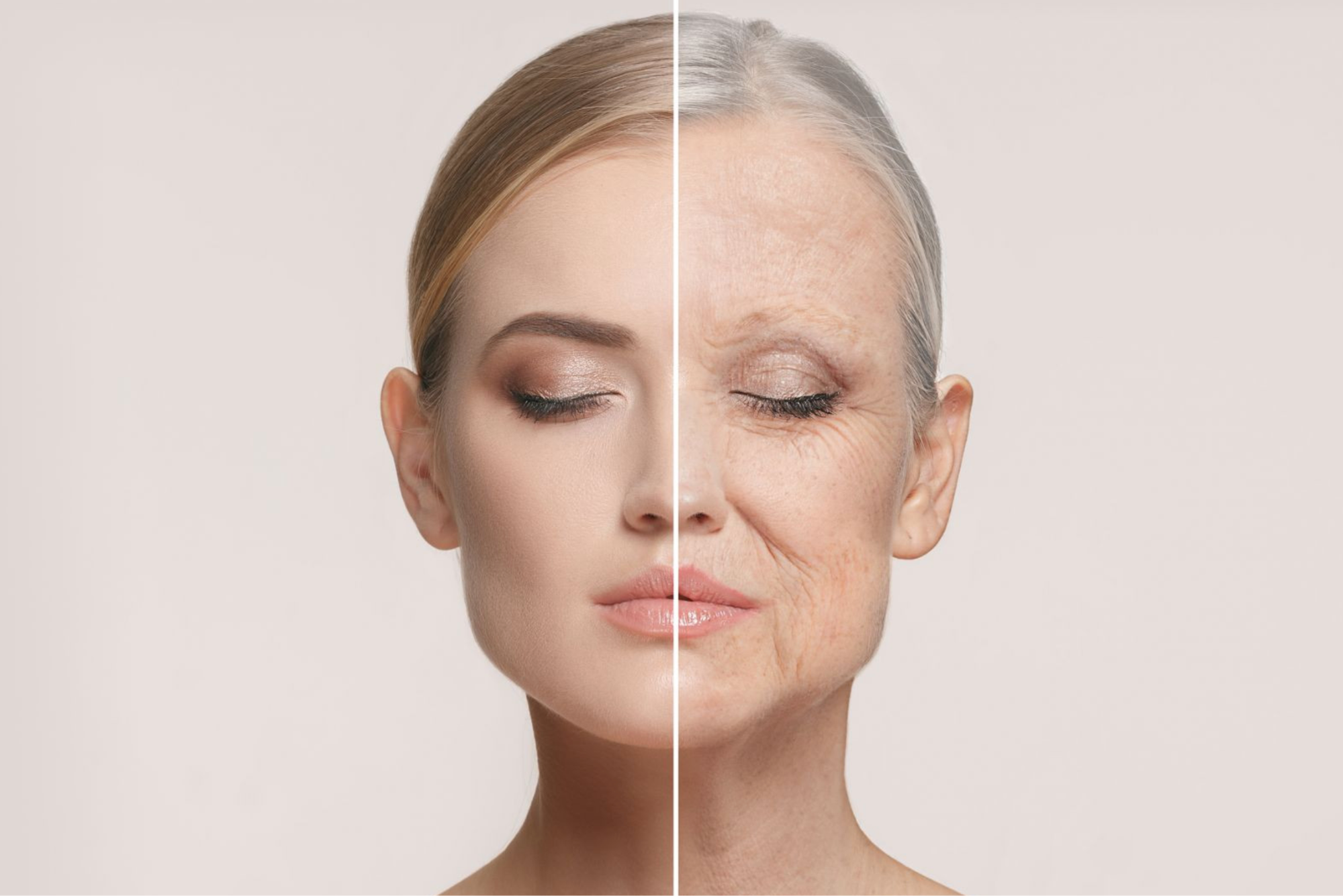 Sự suy giảm collagen và elastin làm cấu trúc nâng đỡ da yếu dần, khiến các nếp gấp và rãnh trên da rõ hơn.